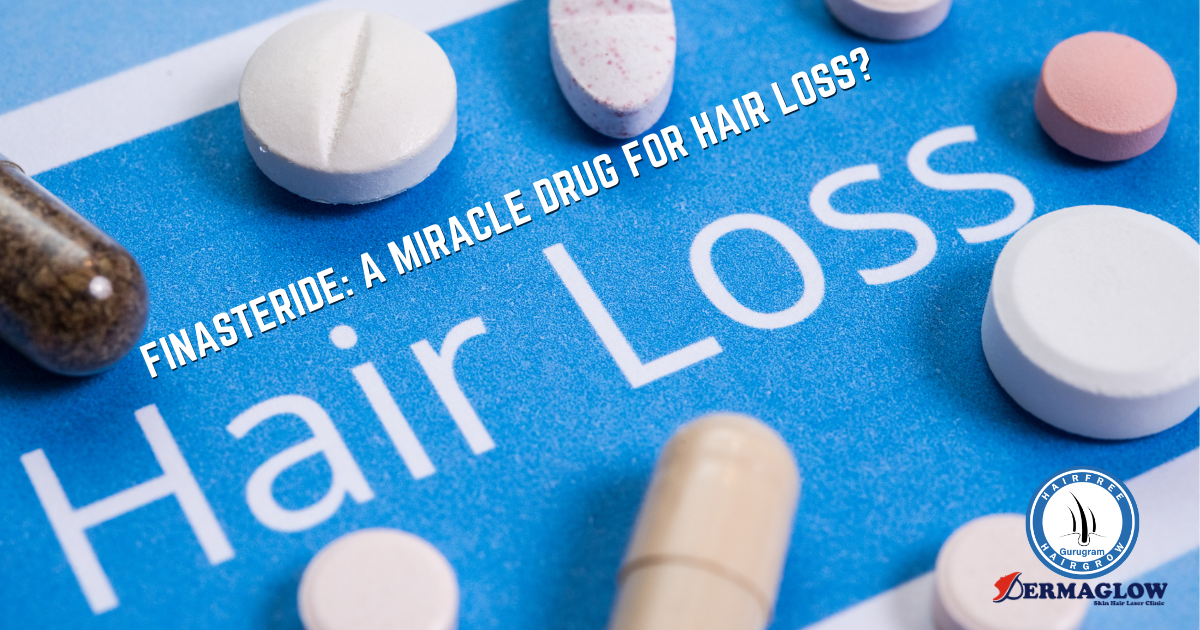 Finasteride: A Miracle Drug for Hair Loss?