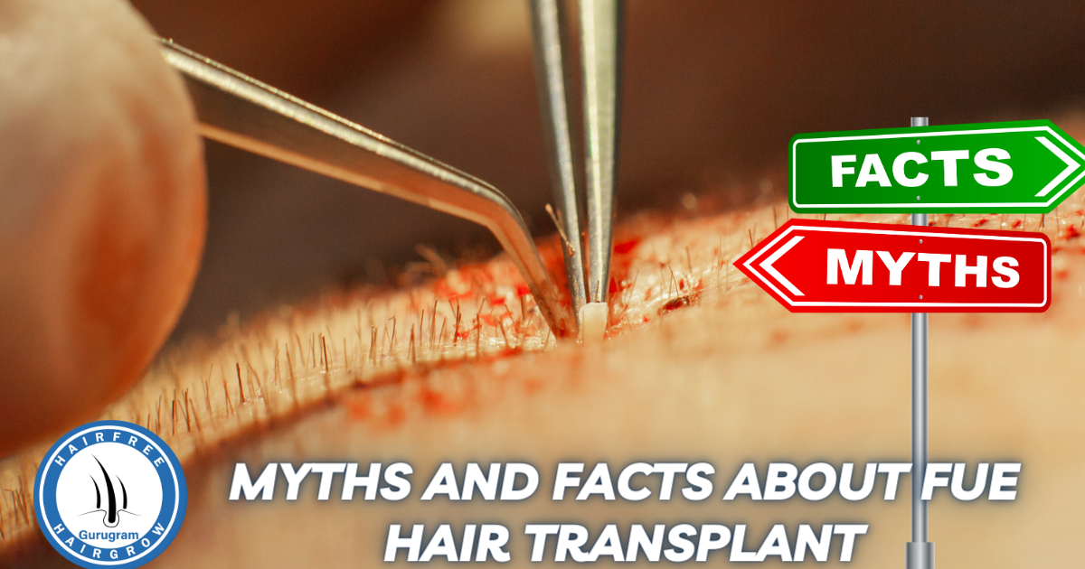 Myths and Facts about FUE Hair Transplant
