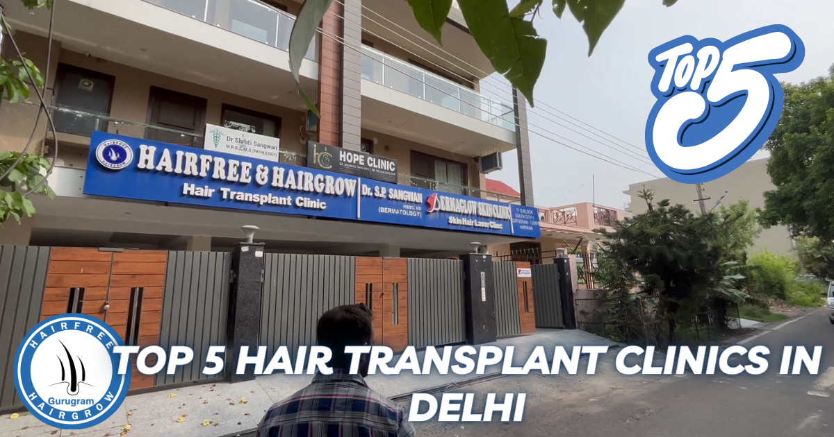 Top 5 Hair Transplant Clinics in Delhi